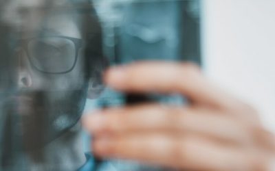 Rib Stress Fracture Treatment in Texas