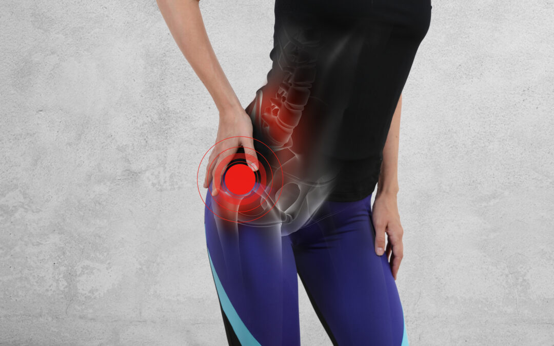 Woman with hip joint pain.