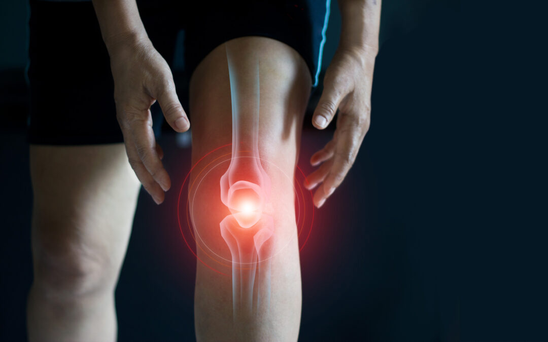 The Importance of Repairing a Meniscal Root Tear