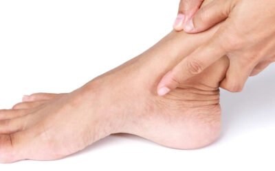 Ankle Ligament Reconstruction: What You Need to Know
